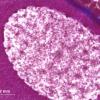 Vésicule germinative d'ovocyte I en prophase de première division de méiose