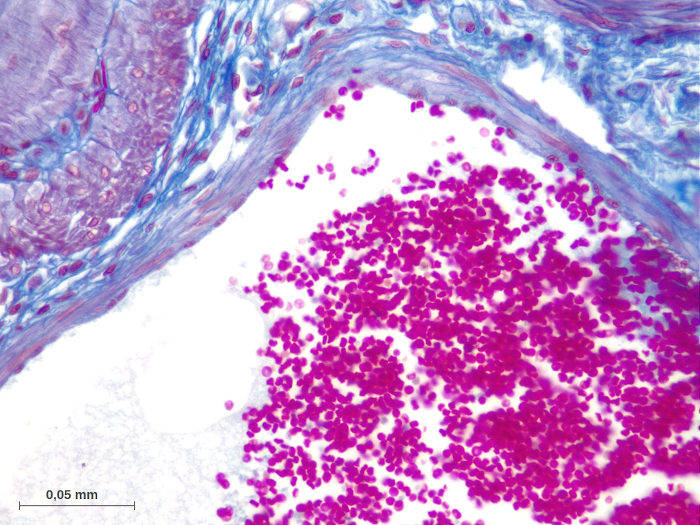 Atlas D Histologie Fonctionnelle De Wheater Pdf