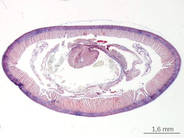 Anatomie du Lombric, avec métanéphridies