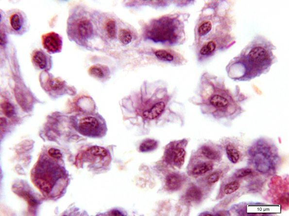 Cœlomocytes de Lombric