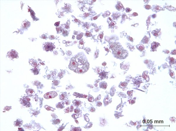 Cœlomocytes de Lombric
