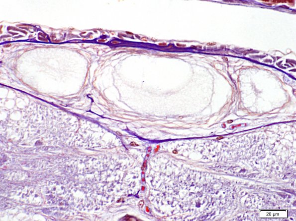 Fibres géantes dorsales de la chaîne nerveuse ventrale