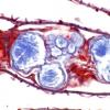 Concrétions des glandes de l'œsophage de Lombric