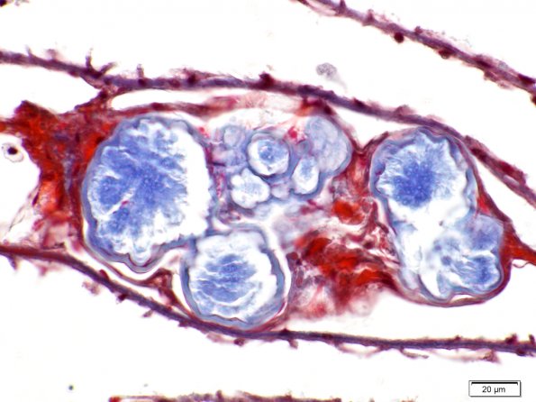 Concrétions des glandes de l'œsophage de Lombric