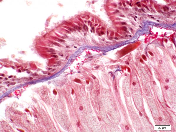 Typhlosole d'intestin de Lombric et chloragocytes