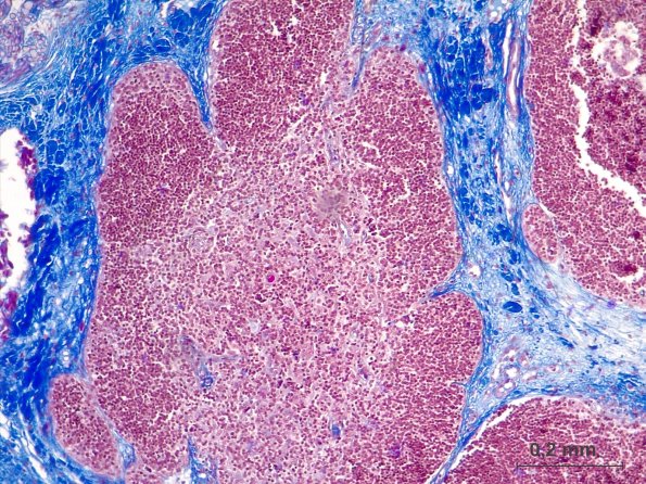 Tissu lymphoïde de septum de branchie de Roussette
