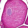 Ovocyte I en prophase de première division de méiose