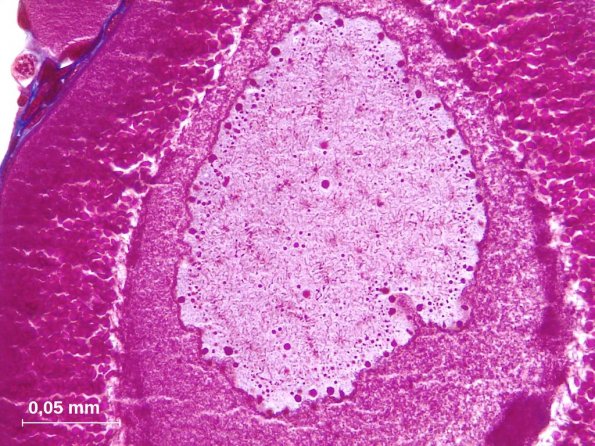 Vésicule germinative d'ovocyte I en prophase de première division de méiose