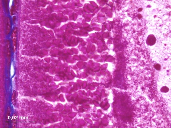 Cytoplasme d'ovocyte I en prophase de première division de méiose