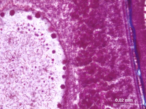 Vésicule germinative et cytoplasme d'ovocyte I en prophase de première division de méiose