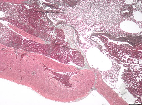 Valvule auriculo-ventriculaire de cœur de Rat
